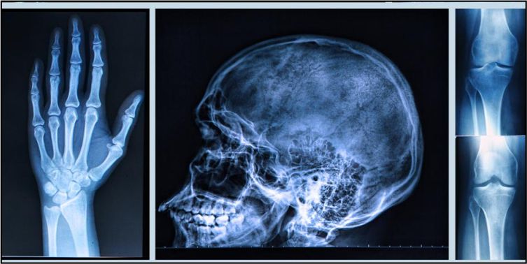 Radiology - More Hospital