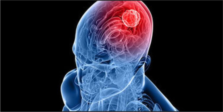 Neuro Medicine And Neuro surgery - More Hospital